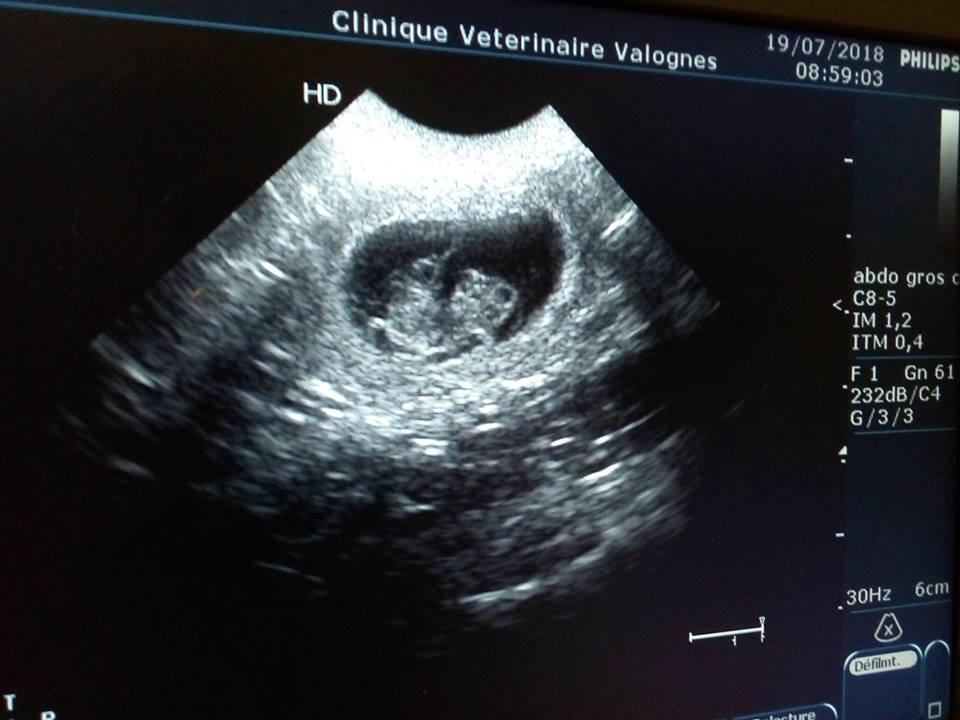 Echographie gestation